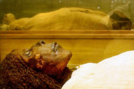 Scientists found no signs of cancer in their extensive study of mummies apart from one isolated case