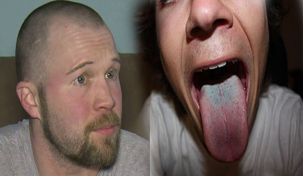 Washington state man arrested for having 'green tongue'