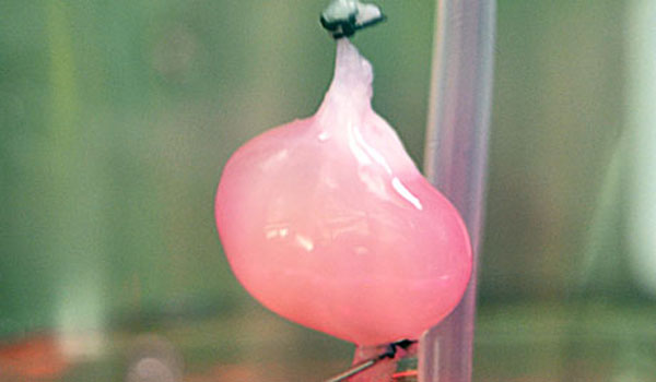 Kidney grown in lab successfully transplanted into rat