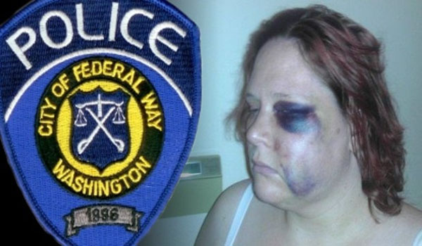 Handicapped Woman Calls 911 During Brutal Beating by Cops