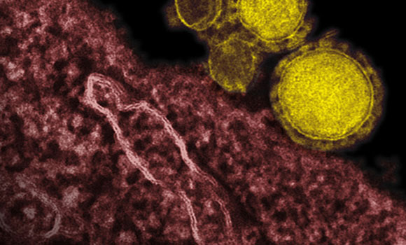 MERS Virus Mysterious New Respiratory Virus Spreads Easily, Appears Deadlier Than SARS