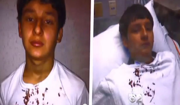 Video Police Break 13-Yr-Old’s Nose For Refusing To Confess To Something He Didn’t Do