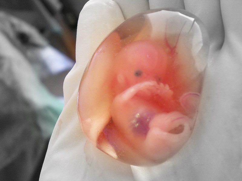 Aborted Babies Are Being Chopped Up And Sold To Researchers All Over America With The Full Approval Of The Obama Administration