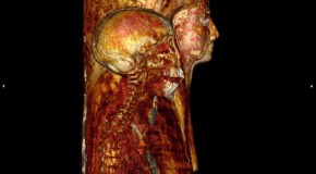 The mummy unmasked: Medical scans give amazing images of ancient Egyptians