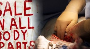 Organs taken from patients that doctors were pressured to declare brain dead