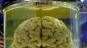 Medical Examiner keeps thousands of brains for ‘tests’ families call needless