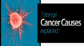 What Causes Cancer? 7 Strange Cancer Claims Explained