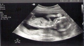 Ultrasound – One of The Worst Things You Can Do To a Developing Fetus