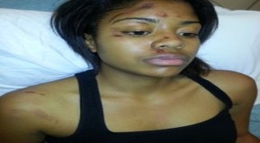 Honor Student Inexplicably Beaten by Police “I Awoke Spitting My Teeth Out On the Ground”
