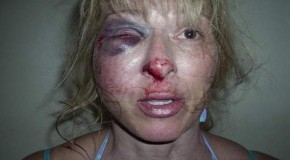 Florida Police Brutality: Woman’s Face Smashed Into Pavement During Arrest