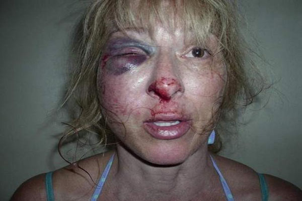 Florida Police Brutality Woman’s Face Smashed Into Pavement During Arrest