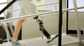 New Prosthetic: Man Controls Bionic Leg with Thoughts