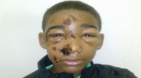 Cops Taser 14-Year-Old in the Face, They Say ‘For His Safety’