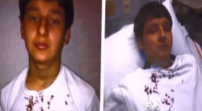 Video: Police Break 13-Yr-Old’s Nose For Refusing To Confess To Something He Didn’t Do
