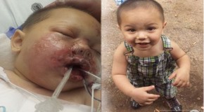 SWAT team throws a stun grenade into a toddler’s CRIB during drugs raid leaving him in a coma with severe burns