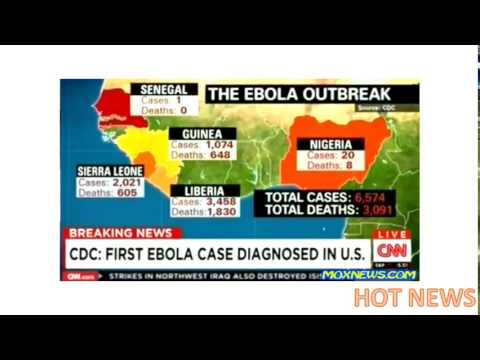 BREAKING! FIRST EBOLA CASE DIAGNOSED IN THE U S ! NOW AT DALLAS TEXAS HOSPITAL!  HOT NEWS