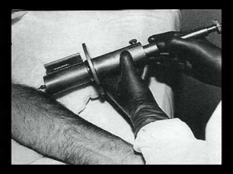 MUST SEE!! History Of Mind-Control – Monarch Chapter 2A      Human Radiation Experiments