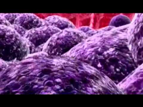 Mellstedt Cancer Vaccine Documentary